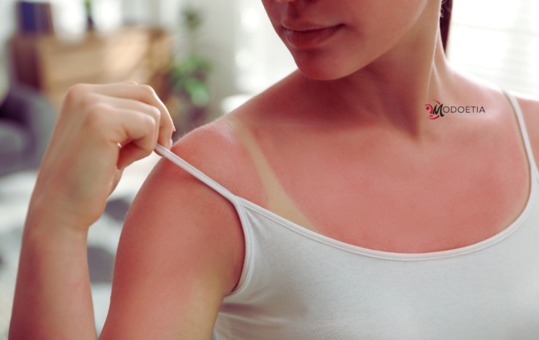 Effetti del sole sulla pelle: cheratosi attinica, fotoinvecchiamento e fotosensibilità